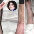 Fotos chocantes das pernas de Michael Jackson são divulgadas