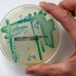 Anvisa anuncia reforço em medidas de combate à ‘superbactéria’