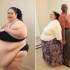 Após alerta de médicos, mulher desiste de ser a mais gorda do mundo