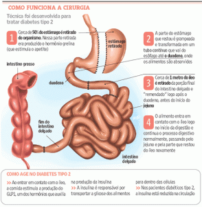 gastrectomia