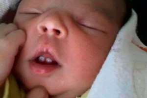 Bebê nasce com dois dentes no Espirito Santo