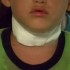 Menino de 7 anos tem pescoço ferido por linha com cerol