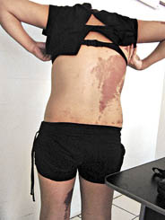 Priscila depois do trote